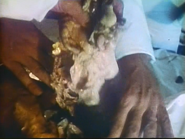 The students learn precision surgical techniques in Andy Milligan's The Man With Two Heads (1972)