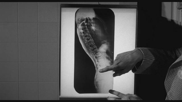 Evidence of the critter's existence shows up on an x-ray in William Castle's The Tingler (1959)